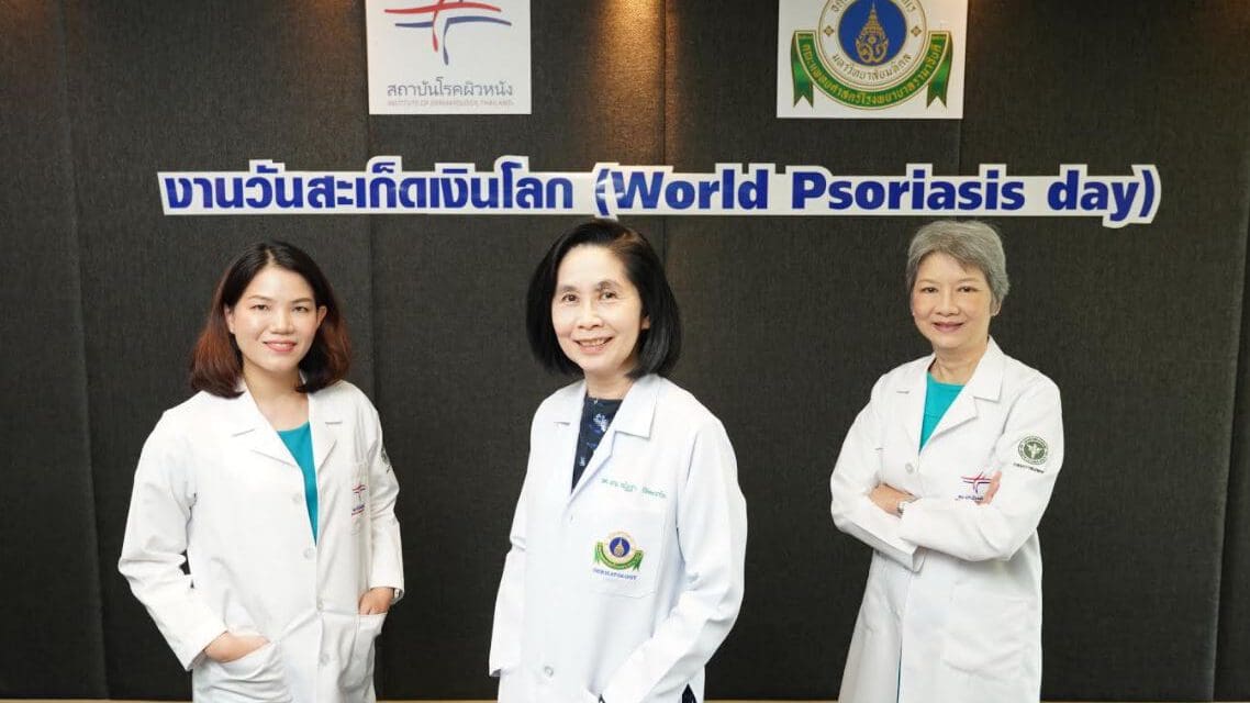 สถาบันโรคผิวหนัง และคณะแพทยศาสตร์ โรงพยาบาลรามาธิบดี ชวนมาทำความรู้จักและเข้าใจ “โรคสะเก็ดเงินเป็นมากกว่าโรคทางผิวหนัง”